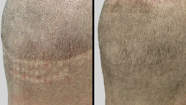 PHAEYDE Hair Transplant Clinic